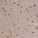 RGS6 Antibody in Immunohistochemistry (Paraffin) (IHC (P))