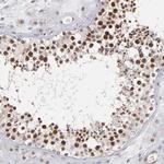 RGS6 Antibody in Immunohistochemistry (Paraffin) (IHC (P))