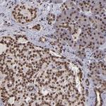 CSDC2 Polyclonal Antibody