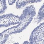 HORMAD2 Polyclonal Antibody