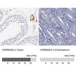 HORMAD2 Antibody in Immunohistochemistry (IHC)