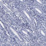 HORMAD2 Antibody in Immunohistochemistry (IHC)