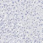 THAP7 Antibody in Immunohistochemistry (Paraffin) (IHC (P))