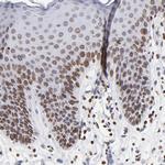 THAP7 Antibody in Immunohistochemistry (Paraffin) (IHC (P))