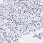 THAP7 Antibody in Immunohistochemistry (IHC)