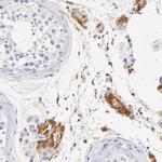 MDGA2 Polyclonal Antibody