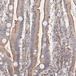 STON2 Antibody in Immunohistochemistry (Paraffin) (IHC (P))