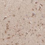 STON2 Antibody in Immunohistochemistry (IHC)