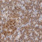 CCDC176 Polyclonal Antibody
