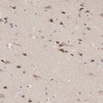 FAM199X Antibody in Immunohistochemistry (Paraffin) (IHC (P))