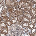 PLXNB2 Antibody in Immunohistochemistry (Paraffin) (IHC (P))