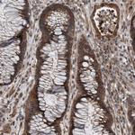 PLXNB2 Antibody in Immunohistochemistry (Paraffin) (IHC (P))