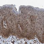 PLXNB2 Polyclonal Antibody