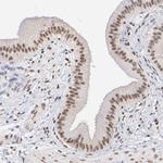 ELMSAN1 Antibody in Immunohistochemistry (IHC)