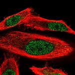 WDR25 Polyclonal Antibody