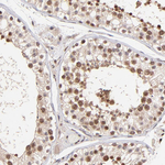 WDR25 Antibody in Immunohistochemistry (Paraffin) (IHC (P))