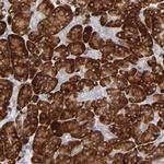 FANCB Antibody in Immunohistochemistry (Paraffin) (IHC (P))
