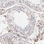 COX8C Polyclonal Antibody