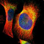 EBP Polyclonal Antibody