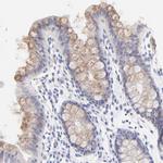 EBP Antibody in Immunohistochemistry (Paraffin) (IHC (P))