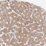EBP Antibody in Immunohistochemistry (Paraffin) (IHC (P))