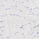 EBP Antibody in Immunohistochemistry (Paraffin) (IHC (P))
