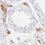 EBP Antibody in Immunohistochemistry (Paraffin) (IHC (P))