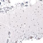 AFF2 Antibody in Immunohistochemistry (Paraffin) (IHC (P))