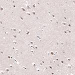 AFF2 Antibody in Immunohistochemistry (Paraffin) (IHC (P))