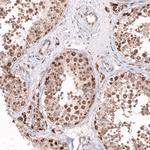 AFF2 Polyclonal Antibody