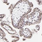 ZNF177 Antibody in Immunohistochemistry (IHC)