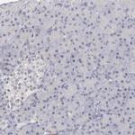 ZNF177 Antibody in Immunohistochemistry (IHC)