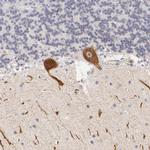 ZNF177 Antibody in Immunohistochemistry (IHC)