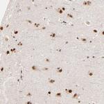 ZNF670 Antibody in Immunohistochemistry (Paraffin) (IHC (P))