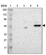 ZNF670 Antibody in Western Blot (WB)
