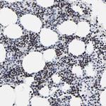 ZNF589 Antibody in Immunohistochemistry (Paraffin) (IHC (P))