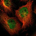 ZNF44 Polyclonal Antibody