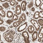 ZNF44 Antibody in Immunohistochemistry (Paraffin) (IHC (P))