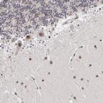ZNF773 Antibody in Immunohistochemistry (Paraffin) (IHC (P))