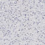 ZNF773 Antibody in Immunohistochemistry (Paraffin) (IHC (P))