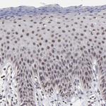 ZNF773 Antibody in Immunohistochemistry (Paraffin) (IHC (P))