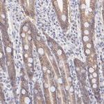 PBDC1 Antibody in Immunohistochemistry (Paraffin) (IHC (P))