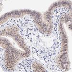PBDC1 Antibody in Immunohistochemistry (Paraffin) (IHC (P))