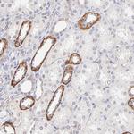PBDC1 Antibody in Immunohistochemistry (Paraffin) (IHC (P))