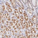 PBDC1 Antibody in Immunohistochemistry (Paraffin) (IHC (P))