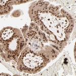 PCQAP Antibody in Immunohistochemistry (Paraffin) (IHC (P))