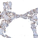 SLC6A14 Antibody in Immunohistochemistry (Paraffin) (IHC (P))