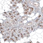 SLC6A14 Polyclonal Antibody