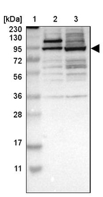 ZFP95 Antibody in Western Blot (WB)