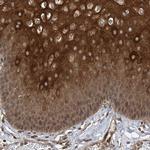 ZFP95 Antibody in Immunohistochemistry (IHC)